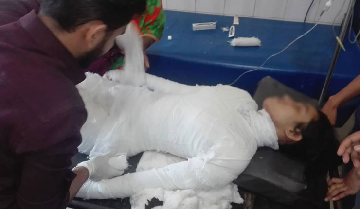 যৌন হয়রানির শিকার সেই ছাত্রীকে আগুন দিয়ে পুড়িয়ে হত্যার চেষ্টা