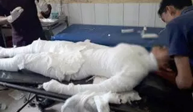 পরীক্ষা কেন্দ্রে গায়ে আগুন: মৃত্যুর সঙ্গে লড়ছেন সেই ছাত্রী