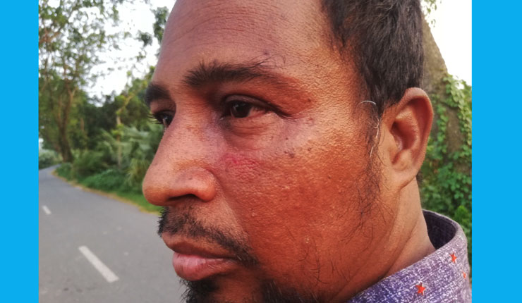 বাগমারায় সন্ত্রাসী হামলায় সাংবাদিক মামুন আহত