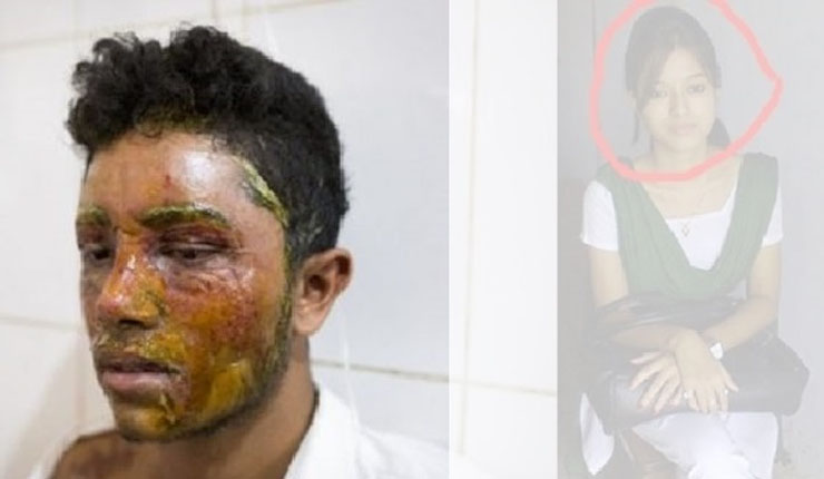 প্রেমের প্রস্তাবে রাজি না হওয়ায় মারুফকে অ্যাসিডে ঝলসে দিল ভাবনা!