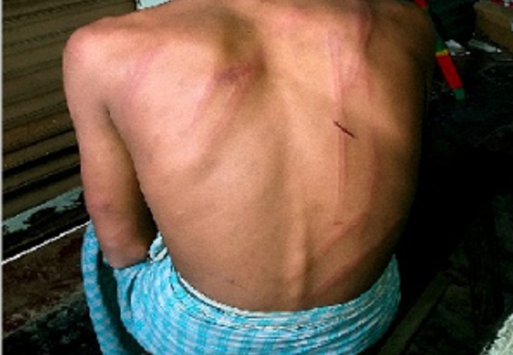 পরকীয়ার কথা স্ত্রীকে বলে দেয়ায় মাদরাসা ছাত্রকে অমানুষিক নির্যাতন 