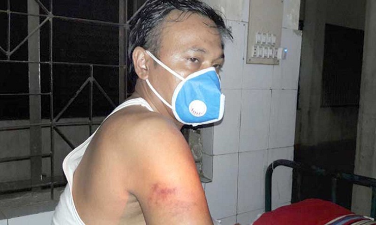 মাস্ক না পরায়  ছাত্রলীগ নেতাকে পেটালো পুলিশ