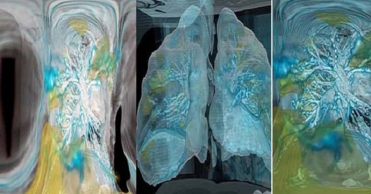 করোনা ভাইরাসটি শরীরে ঢোকার পর কি হয়!