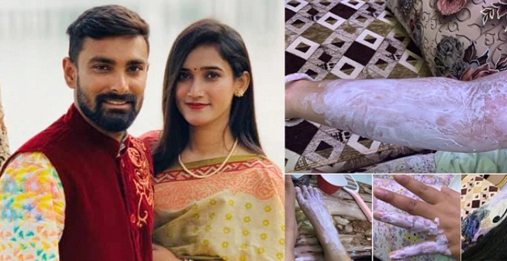 অল্পের জন্য প্রাণে বাঁচলেন লিটনের স্ত্রী