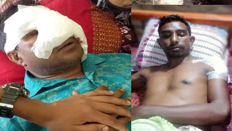 বাগমারায় প্রতিপক্ষের হামলায় আওয়ামীলীগ নেতাসহ আহত ৩