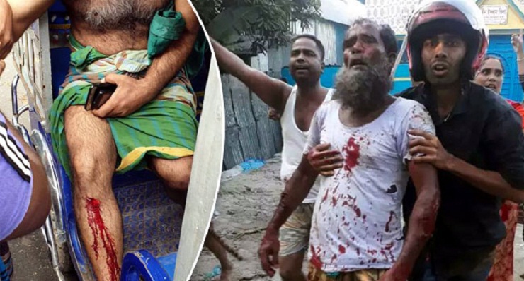 আড়াইহাজারে দুই গ্রুপের মধ্যে রক্তক্ষয়ী সংর্ঘষ, টেটাবিদ্ধসহ আহত ১০