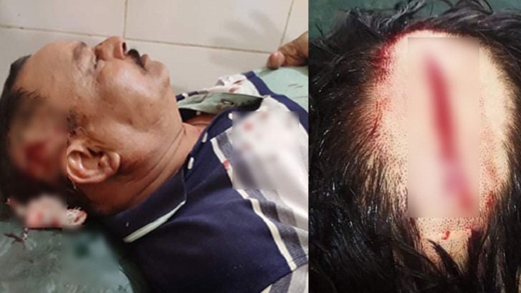 সোনারগাঁওয়ে ছেলেসহ সাবেক চেয়ারম্যানকে কুপিয়ে হত্যার চেষ্টা