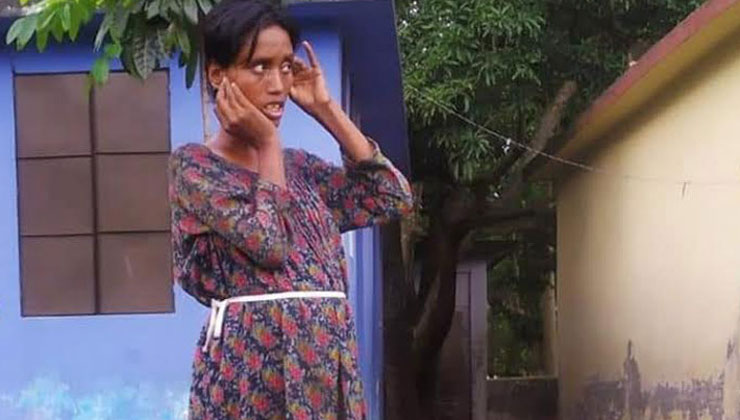সন্তানসম্ভবা প্রতিবন্ধী  কে এই তরুণী? 