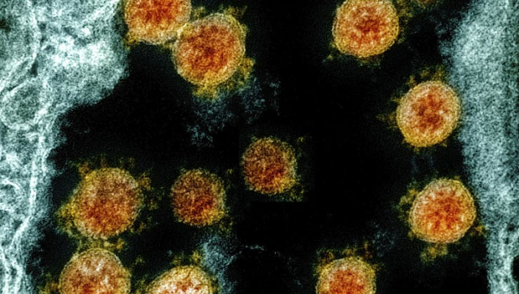 ভ্যাকসিন ছাড়াই নির্মূল হবে করোনা, সুখবর দিলেন গবেষক