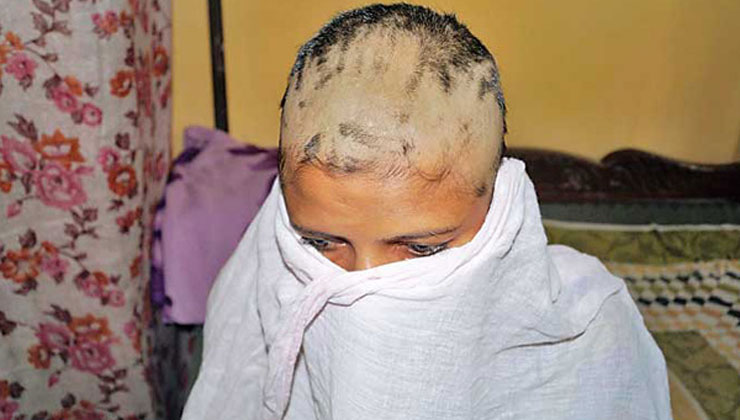 পরকীয়া সন্দেহে ন্যাড়া করে দেওয়া হলো মাথা!