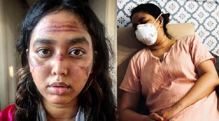 একি হাল অভিনেত্রী ভাবনার!