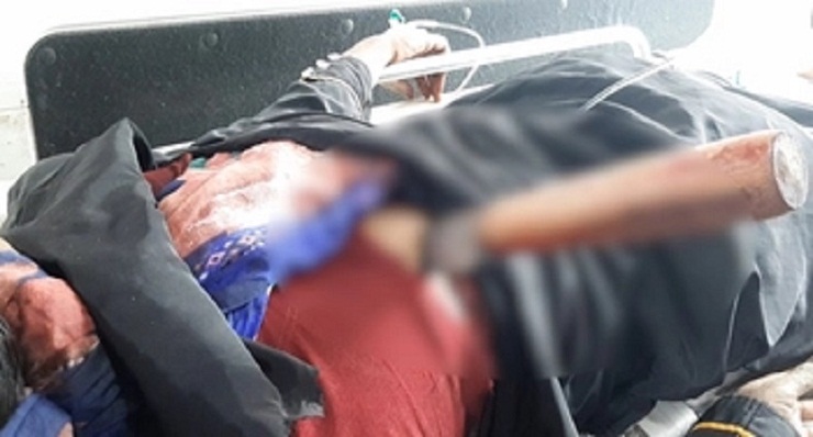 অবিশ্বাস্য, বুকে ছুরি নিয়ে ১২ ঘণ্টায় চার হাসপাতাল ঘুরে ঢাকায়