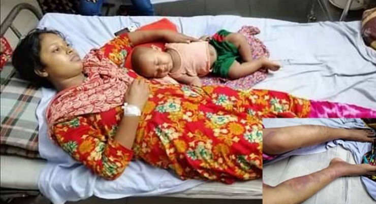 স্ত্রীকে গরম খুন্তির ছেঁকা