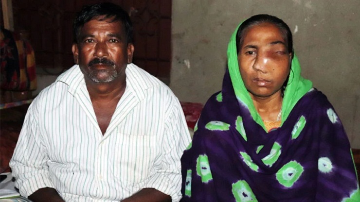 ভিক্ষা করে নিজের ওষুধের খরচ জোগান জহুরা