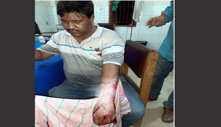 আত্রাইয়ে ইউপি চেয়ারম্যানকে কুপিয়ে জখম করেছে দুর্বৃত্তরা