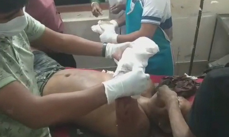 শ্রমিক লীগ নেতার হাত কেটে নিলো সন্ত্রাসীরা