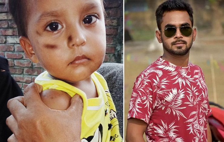 সম্পত্তির লোভে ২ বছরের শ্যালককে মারধর, সিগারেটের ছ্যাঁকা