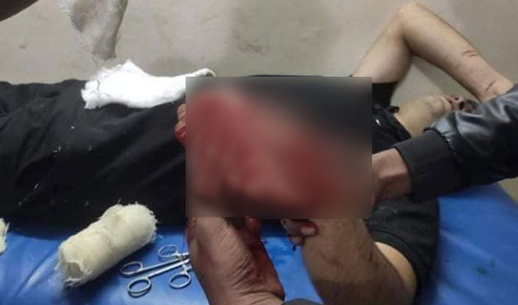 কুপিয়ে ছাত্রলীগ নেতার কব্জি কাটল বিএনপি নেতা