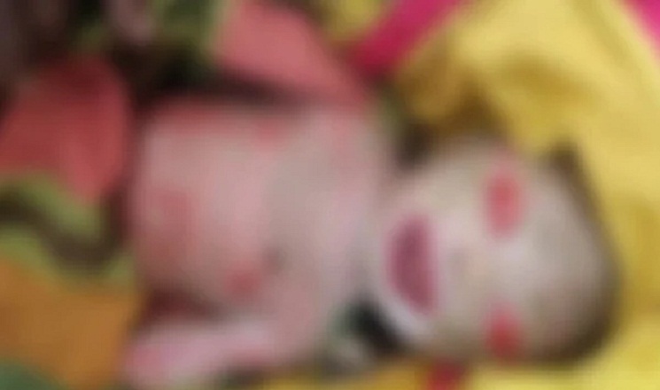 বেদে পরিবারে জন্মালো অদ্ভুত শিশু, দেখতে এলাকাবাসীর ভিড়