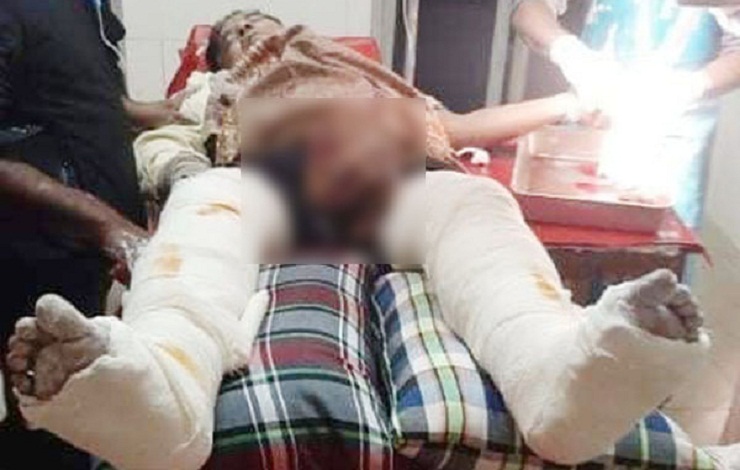 ফরিদপুরে শ্রমিক লীগের নেতাকে কুপিয়েছে দুর্বৃত্তরা