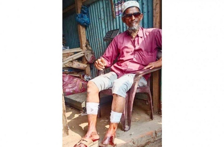 ভোটে হারায় সংঘর্ষ, কাউন্সিলরসহ আটক ২ 