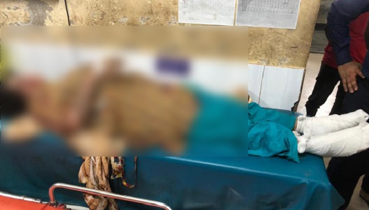 ফেনীতে ভবনে বিস্ফোরণ, দুই মেয়েসহ দগ্ধ মা