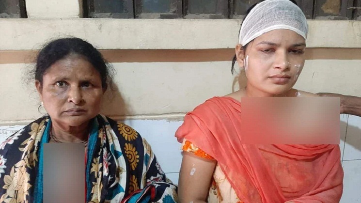 অ্যাসিডে ঝলসে দিল স্ত্রী-শাশুড়িকে