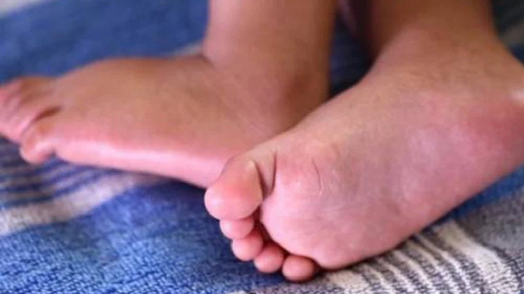 বিচ্ছিন্ন ২ পা উদ্ধার, দেহের সন্ধানে পুলিশ
