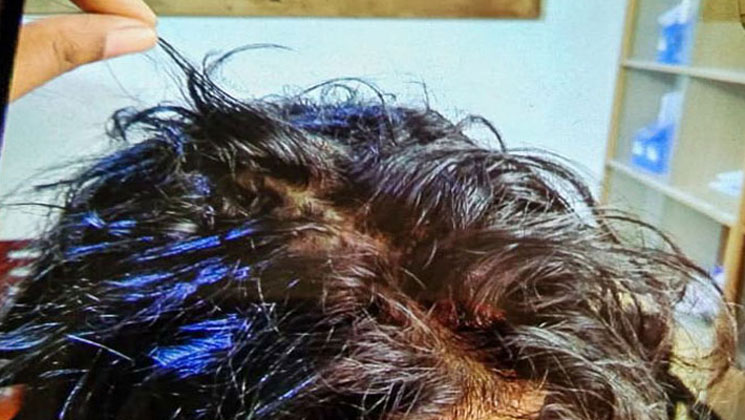 বাবার সম্পত্তি চাওয়ায় শিক্ষক বোনের চুল কেটে দিলো আপন ভাই