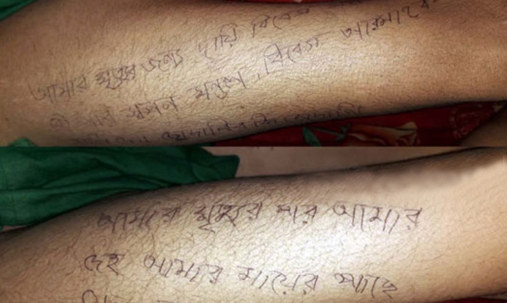 দুই পায়ে মৃত্যুর কারণ ও দায়ীদের নাম লিখে গেলেন গৃহবধূ