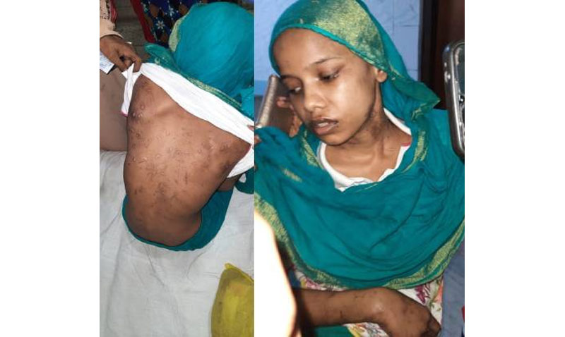 ব্যাংকার দম্পতির বিরুদ্ধে কিশোরী গৃহকর্মীকে নির্যাতনের অভিযোগ