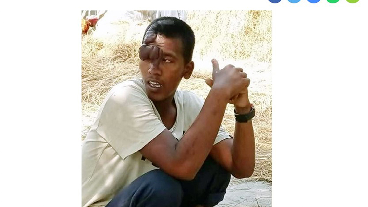 মাকে বাঁচাতে গিয়ে প্রতিবন্ধী পুত্র খুন