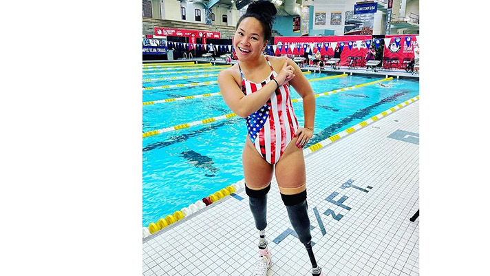 গল্পটা ১৪ মাস বয়সে শরীরে মা-বাবার বেঁধে দেওয়া বোমা থেকেও বেঁচে ফেরার