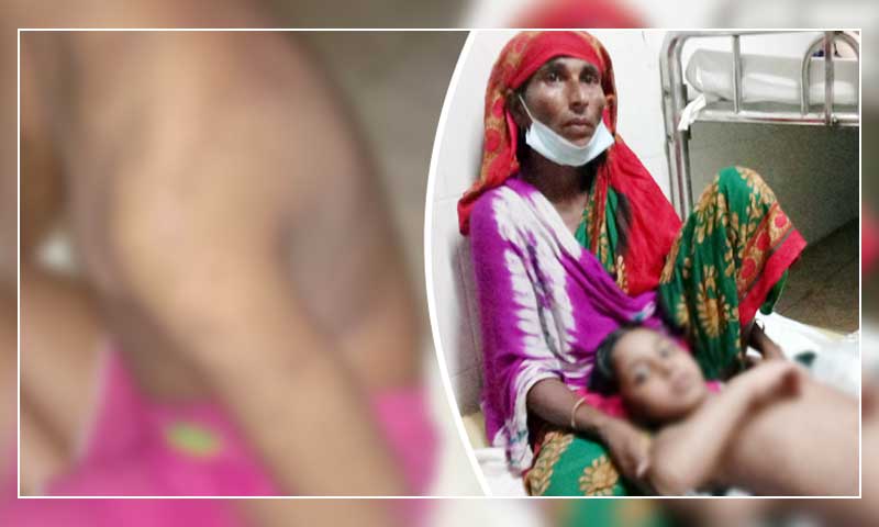 পুলিশ কর্মকর্তার স্ত্রীর বিরুদ্ধে শিশু গৃহকর্মীকে নির্যাতনের অভিযোগ