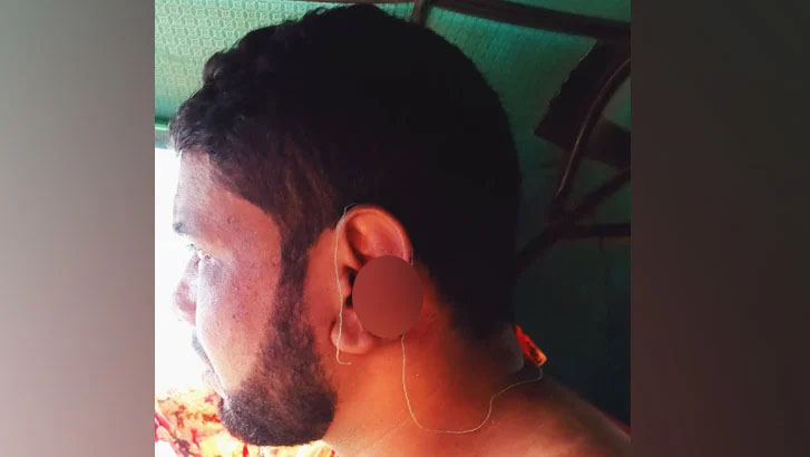 সুদের টাকা না পেয়ে কান কেটে দিল দাদন ব্যবসায়ী