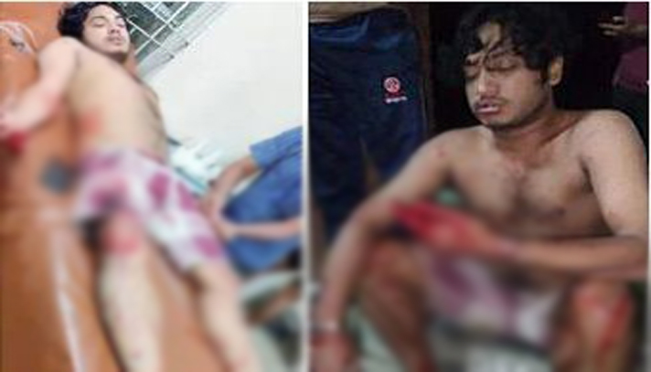 নিজের কর্মীদের কুপিয়ে জখম করল ছাত্রলীগ