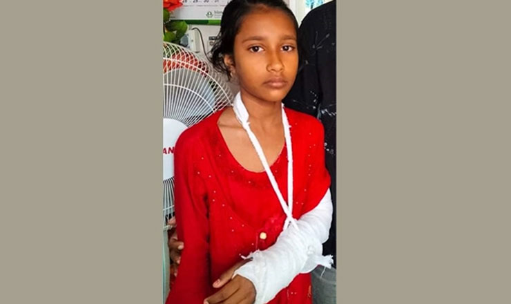 শিক্ষকের পিটুনিতে হাতের হাড় ভাঙলো ছাত্রীর