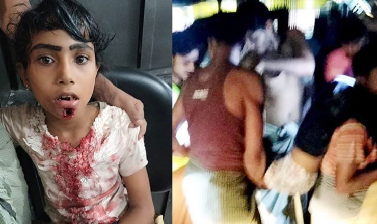 সীমান্তে রোহিঙ্গা ক্যাম্পে মিয়ানমারের গোলায় নিহত ১, আহত ৬