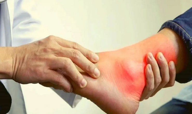 রাতে কোন খাবার খেলে বাড়ে ইউরিক অ্যাসিডের সমস্যা