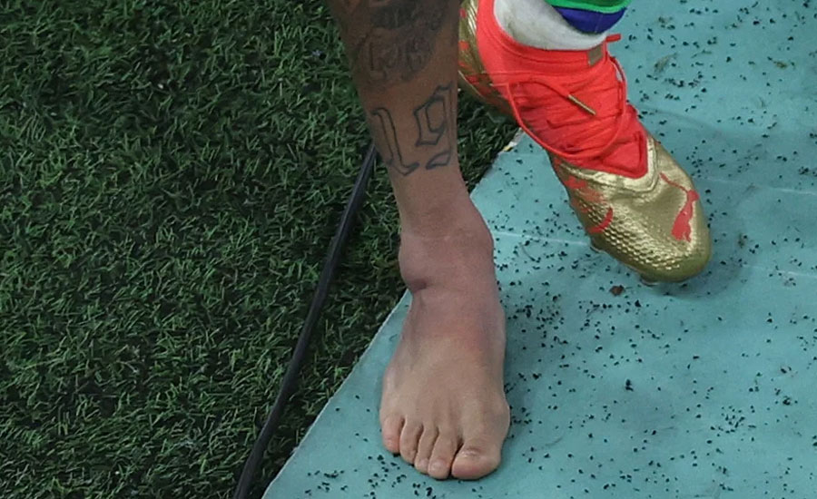 নেইমারের পায়ের গোড়ালির চোট কতটা মারাত্মক