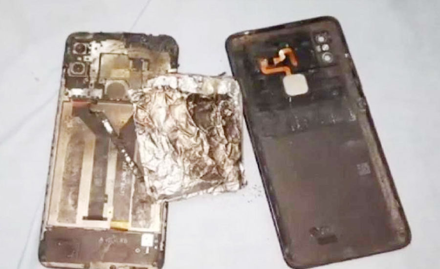 শাওমি ফোন বিস্ফোরণে আগুনে পুড়ে আহত কিশোর
