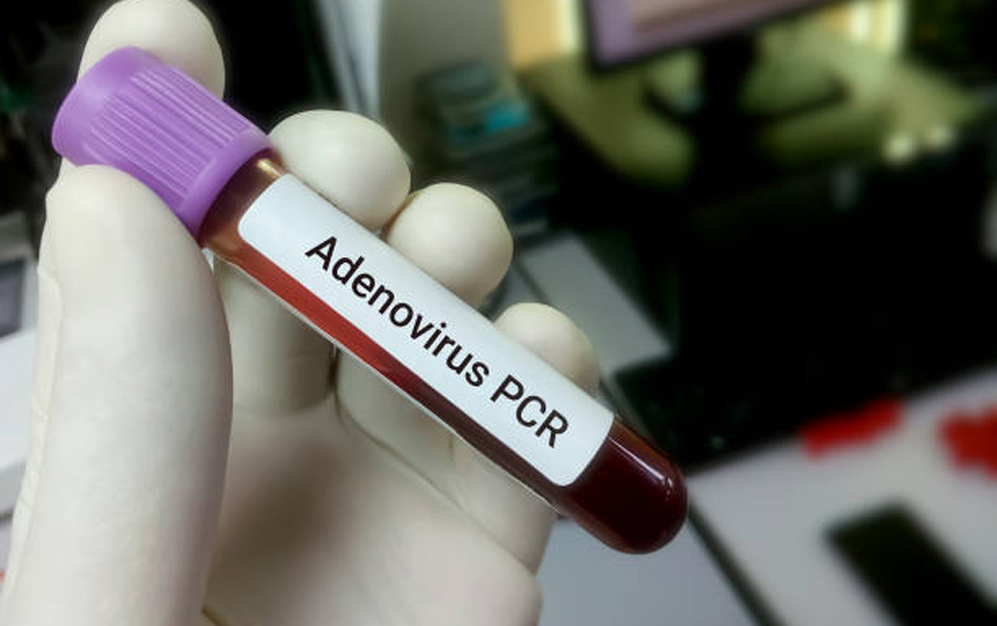 করোনার পর অ্যাডিনোভাইরাসে কাবু কলকাতা, একই উপসর্গ নিয়ে ভিড় ঢাকার হাসপাতালেও
