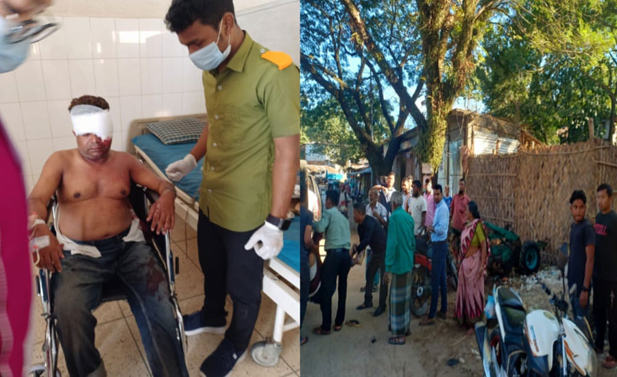 রাজস্থলী প্রেসক্লাবের সভাপতি সড়ক দুর্ঘটনায় গুরুতর আহত