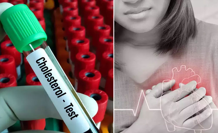 রক্তে খারাপ কোলেস্টেরল কেন বাড়ে