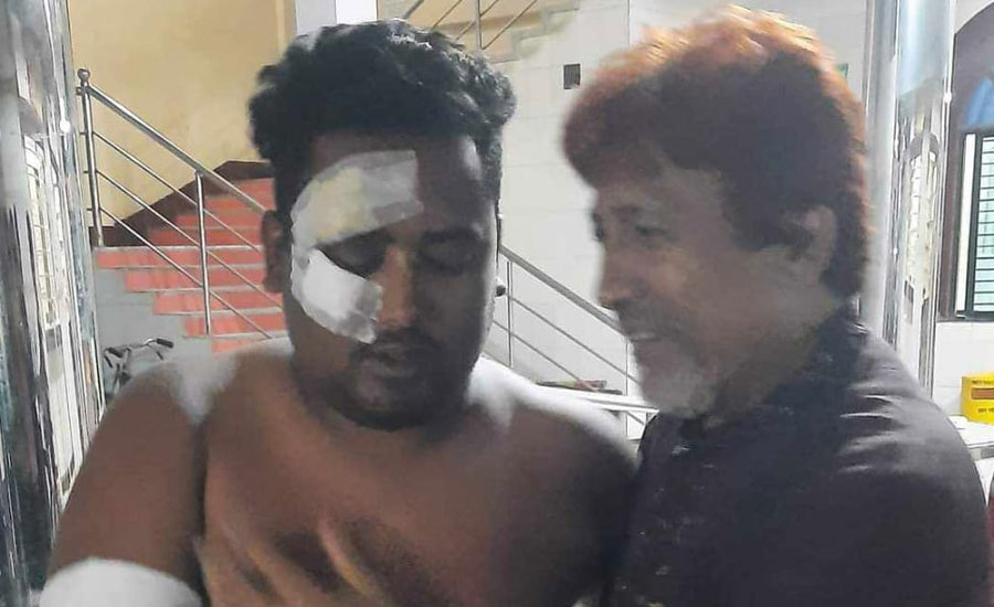 মহাসড়কে শিয়ালের বিচ্ছিন্ন দেহাংশ, পিছলে সাংবাদিক গুরুতর আহত 