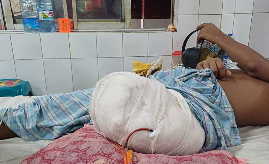 বারবার অস্ত্রোপচার: গুলিবিদ্ধ খোরশেদরা সুস্থ হবেন কি?