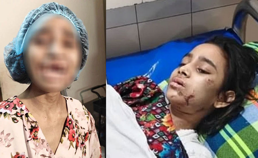 নির্যাতনে চারটি দাঁত হারায় গৃহকর্মী কল্পনা, উদ্ধার হয় যেভাবে