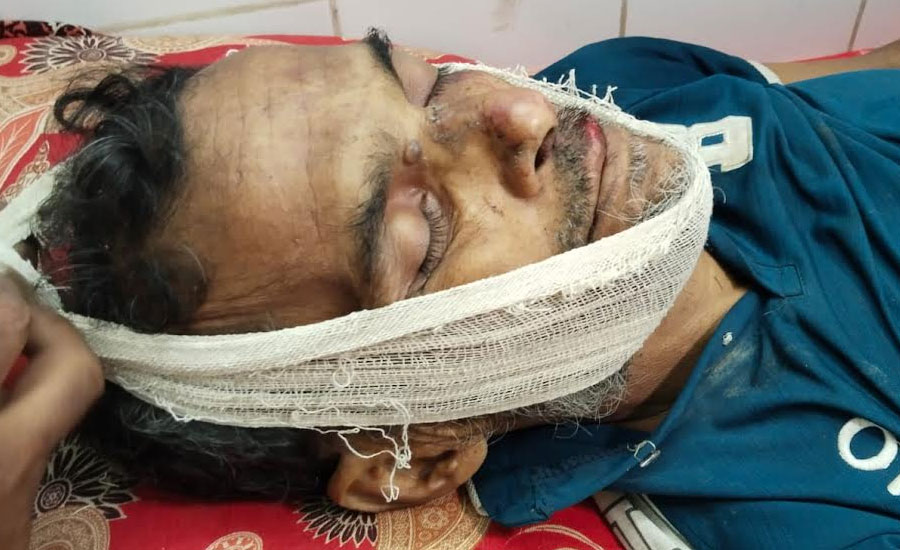 শরণখোলায় বিদ্যুৎস্পৃষ্ঠ হয়ে দিনমজুরের মৃত্যু