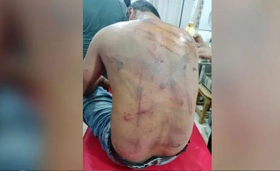 গাজীপুরে শিক্ষককে মারধরের অভিযোগ যুবদল নেতার বিরুদ্ধে