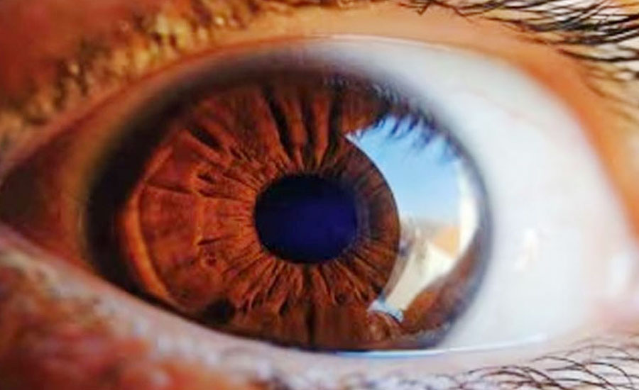 স্ট্রোকের যেসব লক্ষণ ফুটে ওঠে চোখে